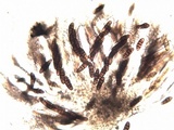 Oedohysterium pulchrum image