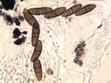 Oedohysterium pulchrum image