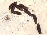 Oedohysterium pulchrum image