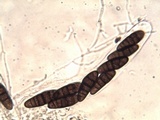 Oedohysterium pulchrum image