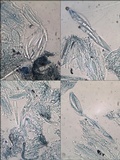 Opegrapha viridis image