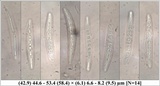Opegrapha viridis image