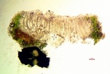 Pertusaria rubefacta image