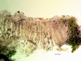 Pertusaria rubefacta image