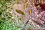 Pertusaria rubefacta image