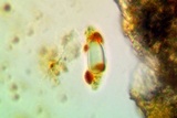 Pertusaria rubefacta image
