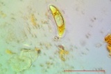 Pertusaria rubefacta image