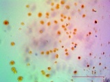 Pertusaria rubefacta image