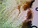 Pertusaria ophthalmiza image