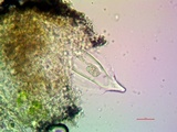 Pertusaria ophthalmiza image