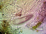Pertusaria ophthalmiza image