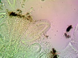 Pertusaria ophthalmiza image