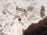 Chaetosphaerella phaeostroma image