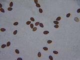 Psathyrella vesiculocystis image