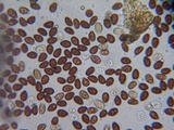 Psathyrella vesiculocystis image