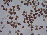 Psathyrella vesiculocystis image