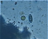Physcia stellaris image