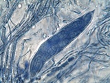 Hysterobrevium smilacis image