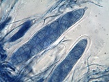 Hysterobrevium smilacis image