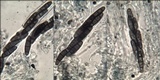 Hysterium angustatum image
