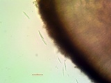 Lecanactis salicina image