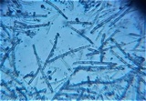 Neodasyscypha cerina image
