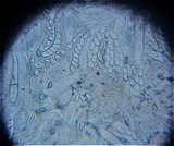 Trapelia glebulosa image