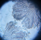 Trapelia glebulosa image