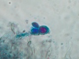 Exidia recisa image