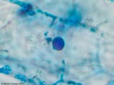 Exidia recisa image
