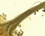 Cephalotrichum microsporum image