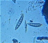Thaxteriella pezizula image