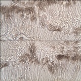 Polychidium muscicola image