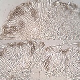 Polychidium muscicola image