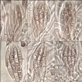 Polychidium muscicola image