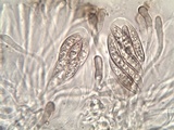 Polychidium muscicola image
