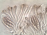 Polychidium muscicola image