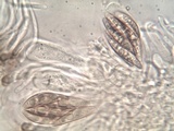 Polychidium muscicola image