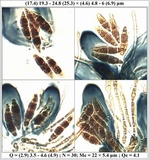 Polychidium muscicola image