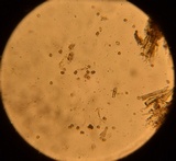 Tomentella cinereoumbrina image