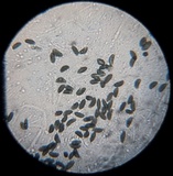 Xylaria arbuscula image