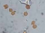 Laccaria fraterna image