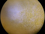 Dacrymyces capitatus image