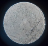 Dimerella lutea image