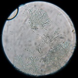 Dimerella lutea image