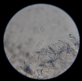 Pseudopithyella minuscula image