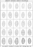 Rinodina oxydata image