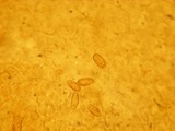 Gastroboletus turbinatus image