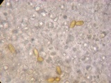 Gastroboletus turbinatus image