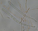 Scutellinia crinita image